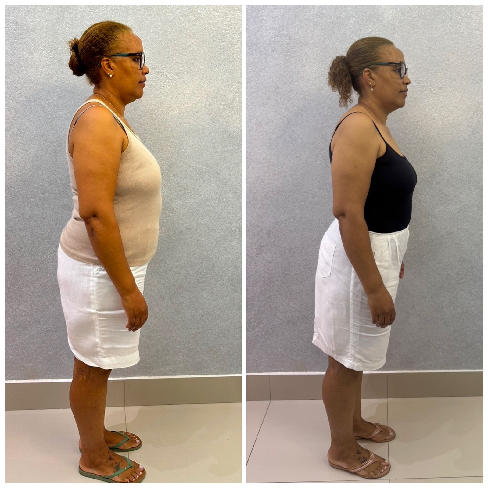 Resultado Antes e Depois